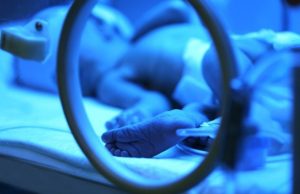 Modern tıbba karşıtlık 2 aylık bebeğin entübe edilmesine neden oldu!