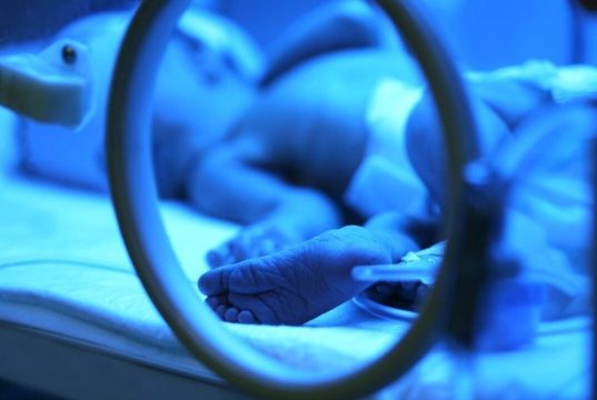 Modern tıbba karşıtlık 2 aylık bebeğin entübe edilmesine neden oldu!